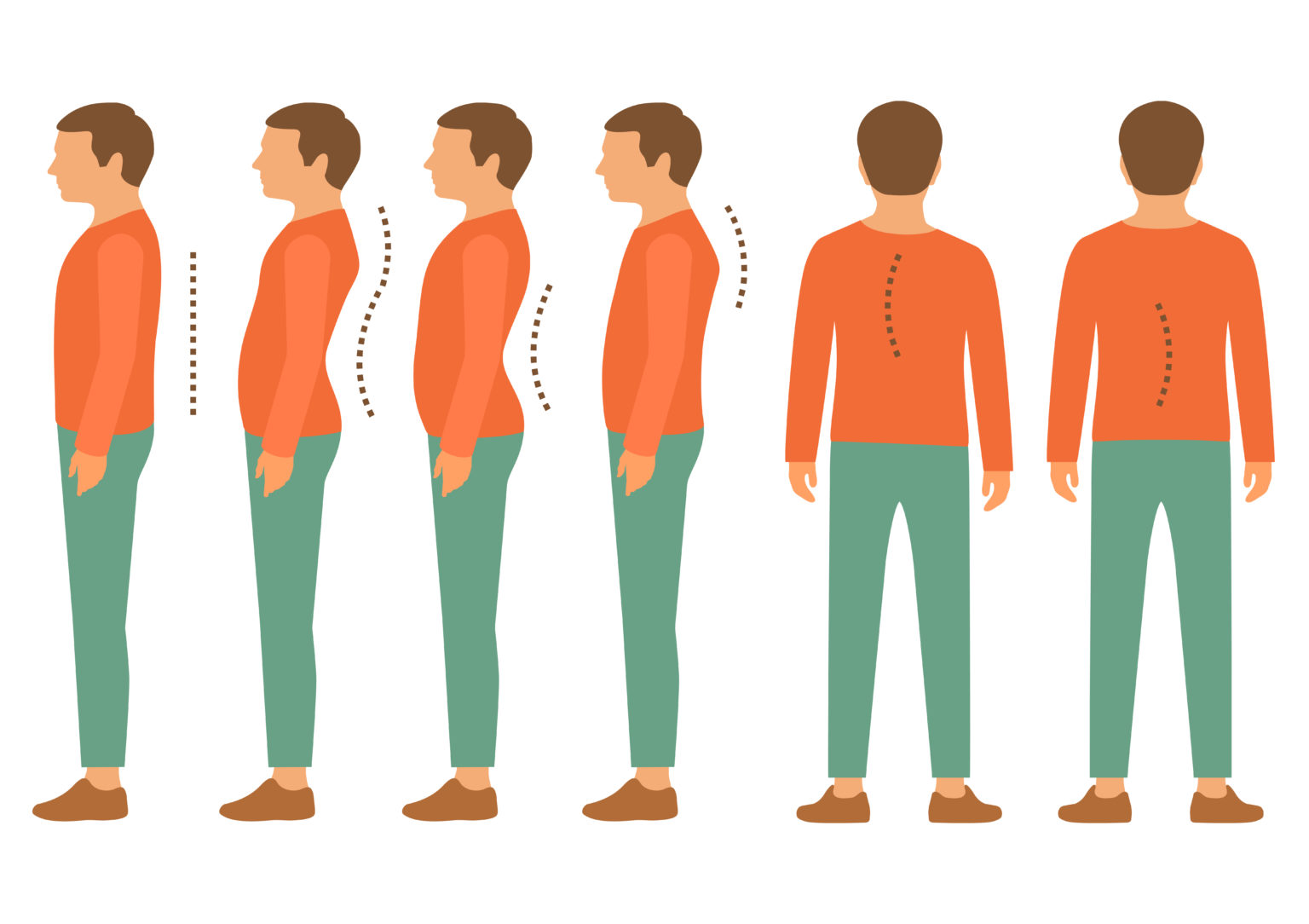 Le Mal De Dos Est Il Lié à De Mauvaises Postures – Mieux Comprendre